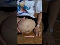 cute girl giving her stump a massage to relieve phantom pain