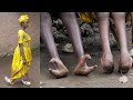 Life With Backward Feet : BORN DIFFERENT