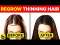 13 Ways To Regrow Your Hair Naturally And Forget About Bald Spots