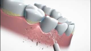 B.Well WI-912 Portable Oral irrigator (short)