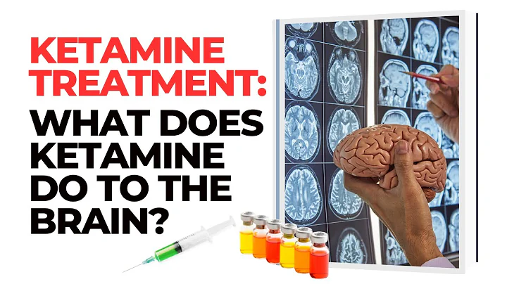 Ketamine Treatment: What Does Ketamine Do To The Brain?