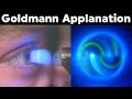 Goldmann Applanation Tonometry Procedure Technique Tutorial