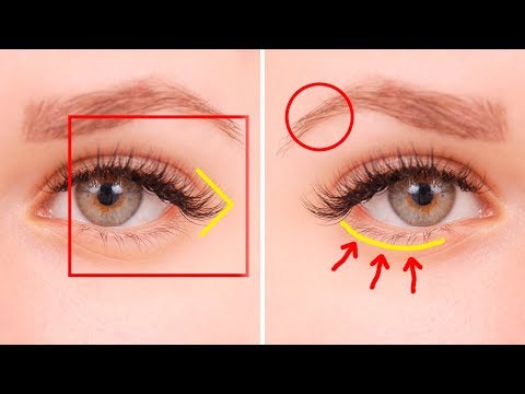 5 Things Your Eyes Are Trying To Tell You About Your Health