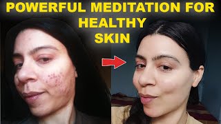 MOST POWERFUL MEDITATION FOR BEAUTY|CLEAR SKIN|HEALTHY SKIN|ACNE 30 Day Clear Skin Challenge