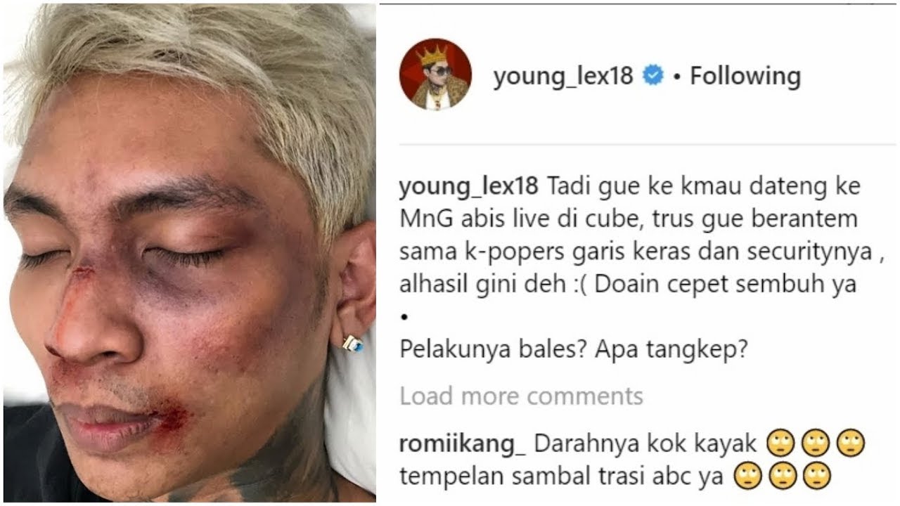 Young Lex Babak Belur Dikeroyok Fans K Pop Garis Keras Kata Netizen Cuma Make Up