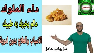 71. داء الملوك/النقرس  ( مالم يخبرك به طبيبك !!! )