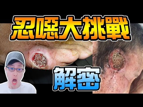 墨鏡哥｜墨名奇妙#1｜4個關於蛆而你不知道的真相！ 恐怖蛆療！