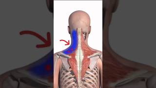 Você Sabia Que Ponto Gatilhos Podem Gerar Dor Irradiada Para Outros Locais?