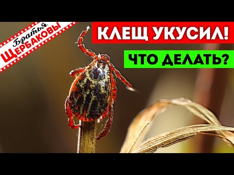 КЛЕЩ УКУСИЛ… Что делать? ТРИ лучших СПОСОБА спасения!