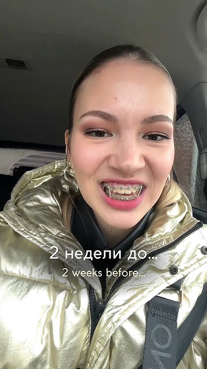СНЯТИЕ БРЕКЕТОВ 🦷 BRACES OFF 🙈 - YouTube