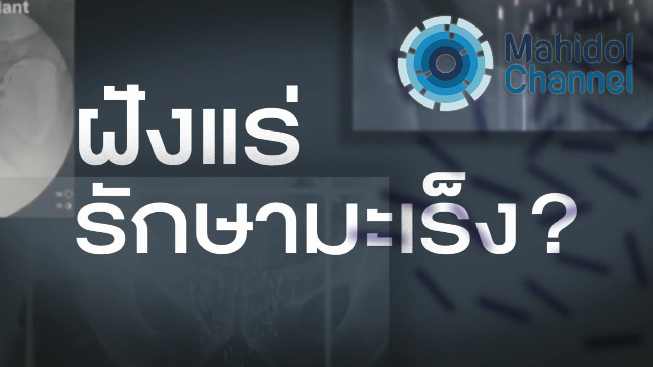 คลิป MU [by Mahidol] ม.มหิดลไขทุกข้อสงสัยเรื่อง ฝังแร่รักษามะเร็ง? กับหัวหน้าภาควิชารังสีวิทยา รามาฯ