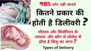 कितने प्रकार की होती है डिलीवरी ? (types of delivery)