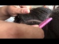 Unexpected Upload: Dandruff Scratching Close Up