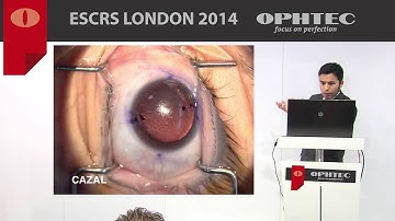 Post operative rotation of Toric IOL By: Dr. J. Cazal, Spain