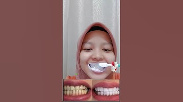 Thumbnail of Aaaa nyesel baru tau sekarang mana udah SP-7