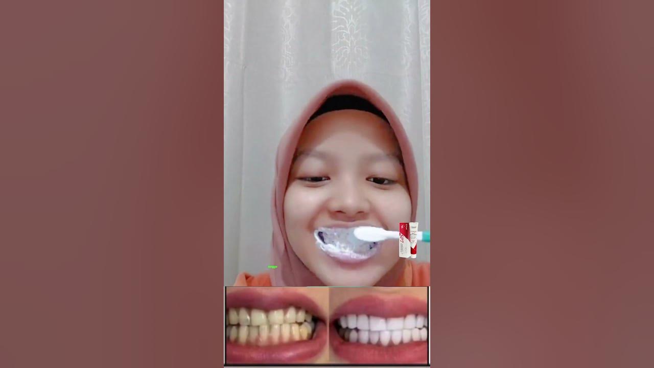 Aaaa nyesel baru tau sekarang mana udah SP-7