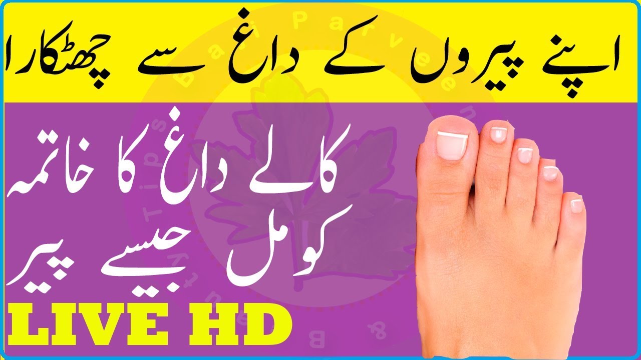 How To Remove Black Spot From Foot - Get Rid of Dark Knees-Ankles At