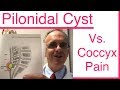 Do you have a PILONIDAL CYST, or is it Coccyx Pain, Tailbone Pain