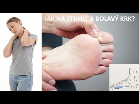 Video: Ztuhlý Krk A Bolest Hlavy: Příčiny A Léčba