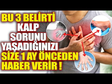 Bu 3 Belirti Kalp Sorunu Yaşadığınızı Size 1 Ay Önceden haber Verir