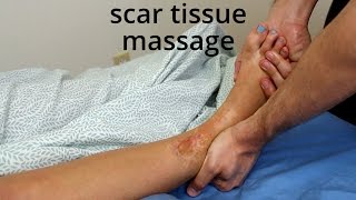 Massage Tutorial: Mature scar tissue myofascial release