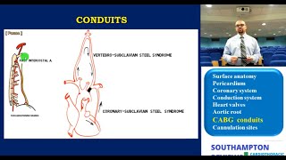 Cardiac Anatomy: CABG Conduits