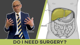 Why Do I Need Surgery To Treat Gallstones?