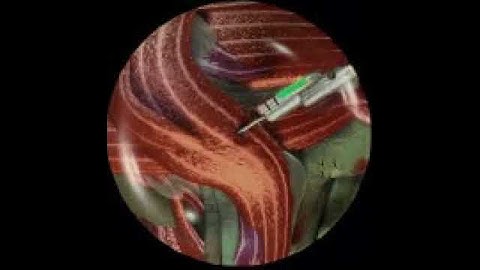 X-COM Interceptor Alien Autopsy clip