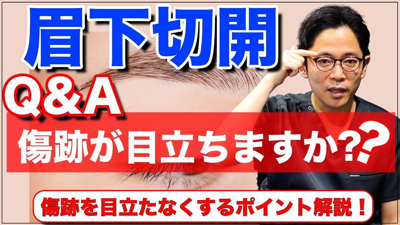 【眉下切開】の『傷跡』について