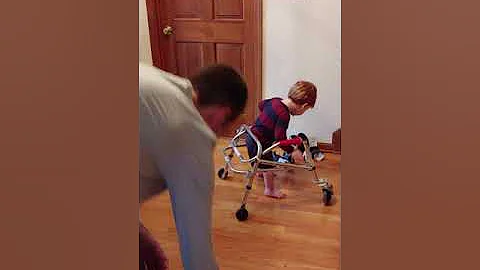 Charlie Walking No Braces (from front, incl transi...