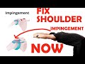 Shoulder impingement