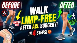 Fix Your ACL Limp With This 1 Walking Drill