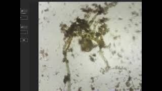 OpenFlexure Microscope Moss Water Sample 1: Rotifer & Ciliate feeding