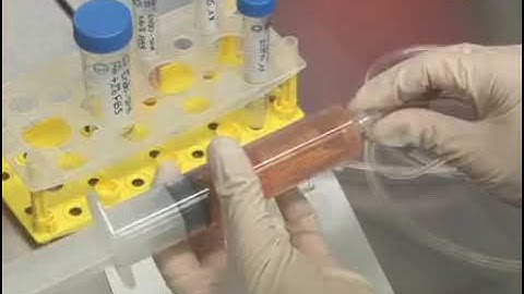 Shear stress plays a crucial role in understanding how bacteria adhere to surfaces