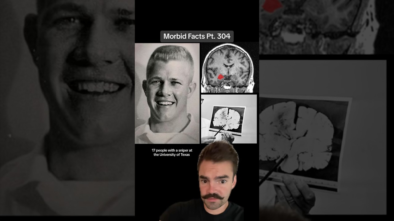 Он убил 17 человек, а потом ЧТО нашли в его мозгу?! 