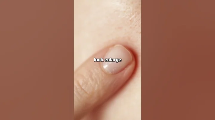 Ways to shrink your pores