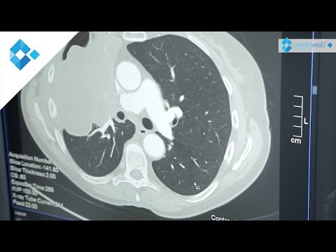 Lungenkarzinom - Diagnostische Mittel | Dr. Kolb