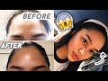 How I Got Rid Of My PIMPLES!! (Philippines) | ThatsBella