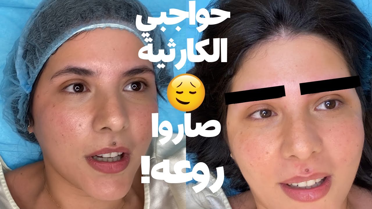 وأخيراً تاتو لحواجبي الكارثية!! أي تقنية استخدمت والنتيجة؟