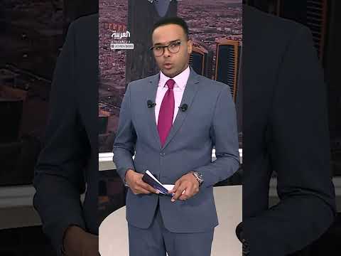 فصل توأم سوري ملتصق في الرياض بتوجيه من الملك سلمان