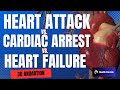 The difference between cardiac arrest heart attack and heart failure  3d animation