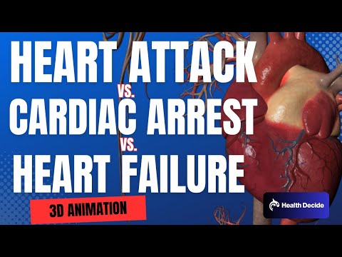 Vídeo: Què distingeix un atac cardíac d'una insuficiència cardíaca?