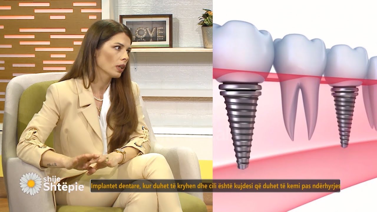 Cili pacient mund të vendosë  implant dentar?