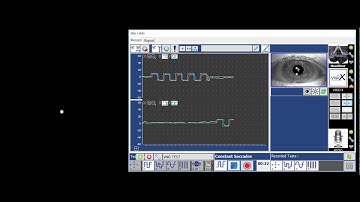 Headstar VNG Regular Saccades