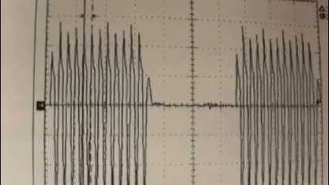 Electrosurge Part III: Crest Factor