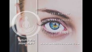 Eliminate Dark Circles and Eye Bags Fast Naturally!