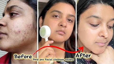 My Acne SkinCare Routine | PMD CLEAN PRO FACIAL CLEANSING DEVICE | Review