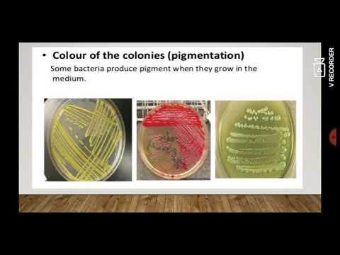 Cultural characteristics & Colony morphology of Bacterial colony