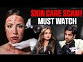 Worst skin care scam must watch ft mausami  night tallk by realhit