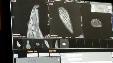 School of Medical Imaging MRI Lab - Fore Foot Part 1